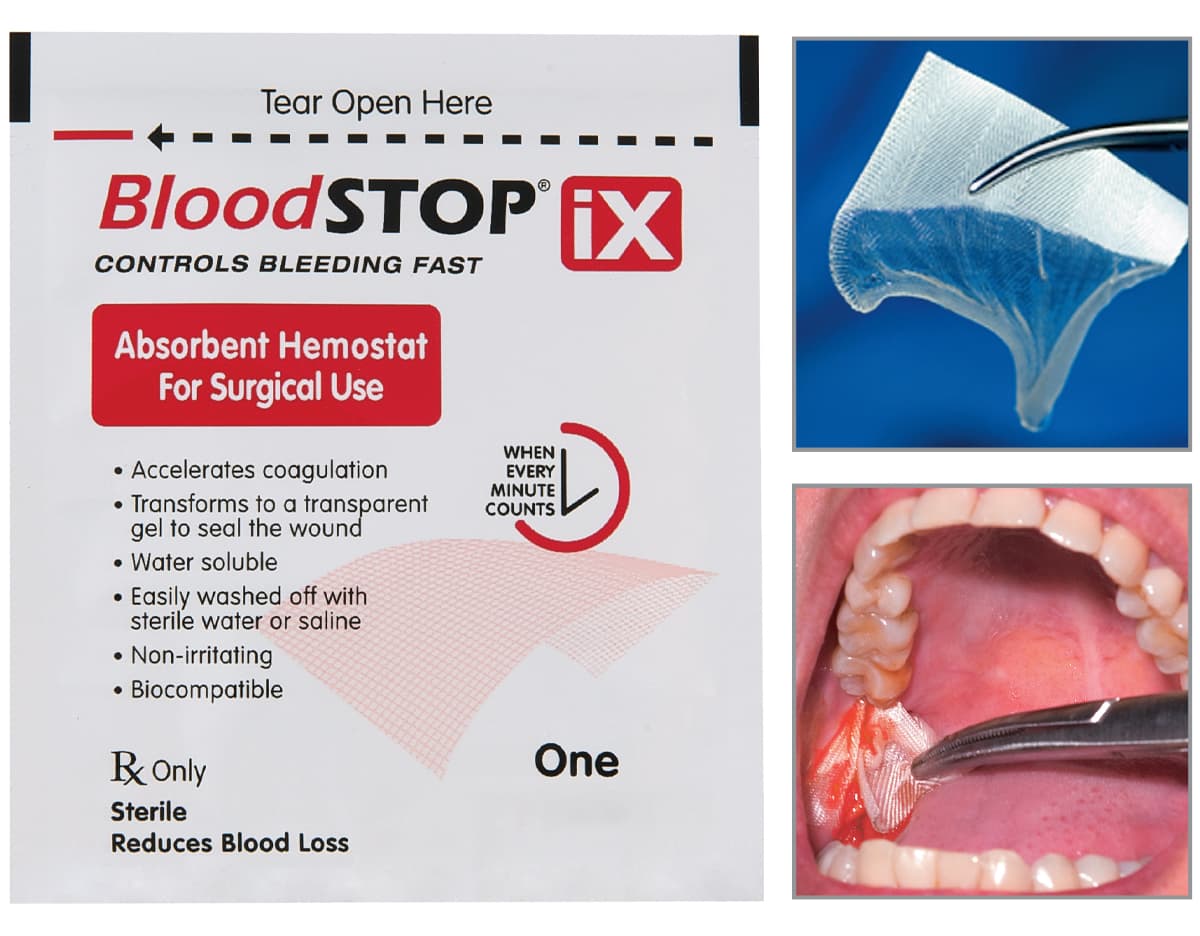 BloodSTOP® Absorbent Hemostatic Gauze 0.5"x 2" - Box of 24