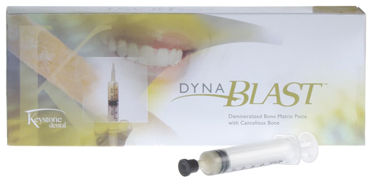DynaBlast Paste