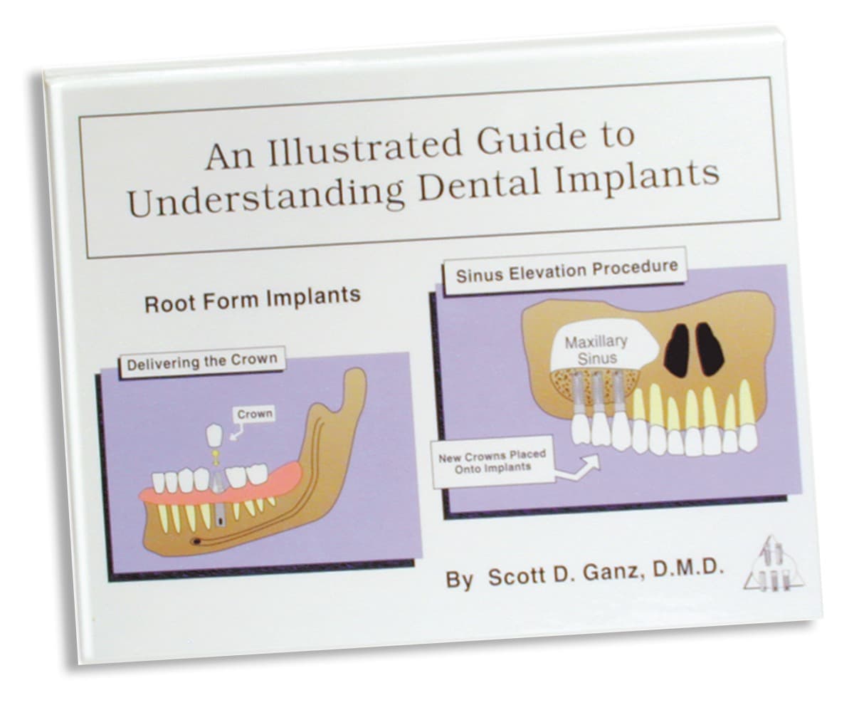 Illustrated Implant Guide By Dr. Scott Ganz (Spanish)
